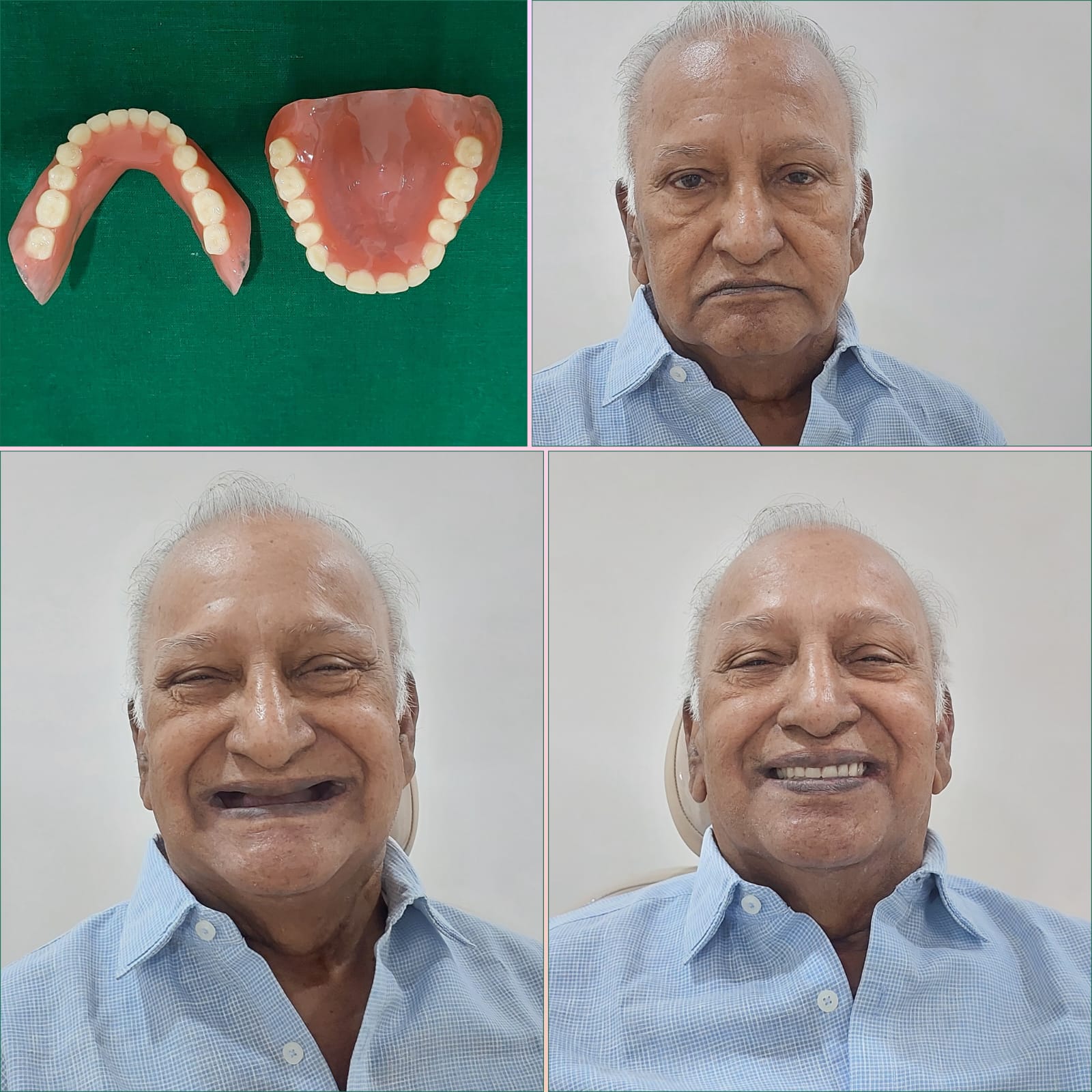 Patient 10